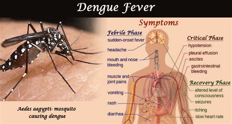 Dengue Fever Symptoms Treatment Prevention