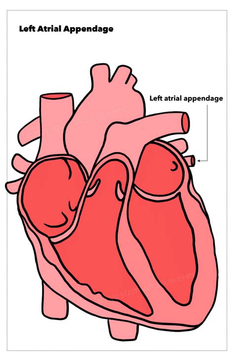 Figure Left Atrial Appendage Heart Illustration By Emma Gregory
