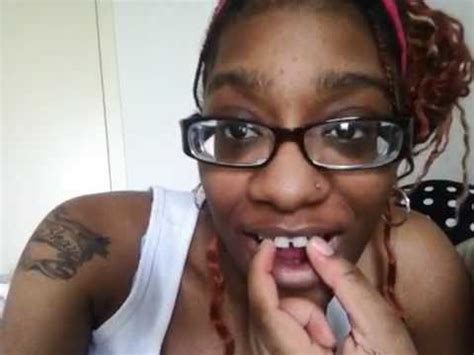 Teeth gaps can be fixed with different dental techniques. Closing my gap DAY1 - YouTube