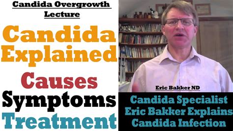 Candida Causes Symptoms And Treatment By Candida Expert Youtube
