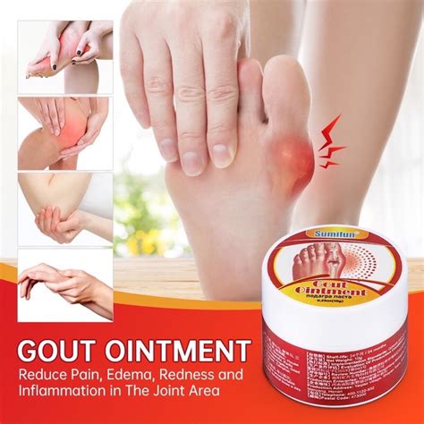 Krim Rawatan Gout Arthritis Melegakan Sakit Sendi Otot Gm Shopee
