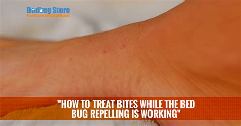 How To Treat Bites While The Bed Bug Repellent Is Working Bb Store