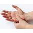 Rheumatoid Arthritis RA Signs And Symptoms  Health Worlds News