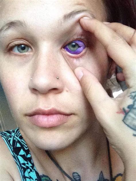 this model got an eyeball tattoo and of course it went horribly wrong theblaze