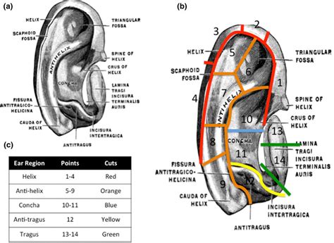 Protocol By Which The Auricular Cartilages Were Dissected According To