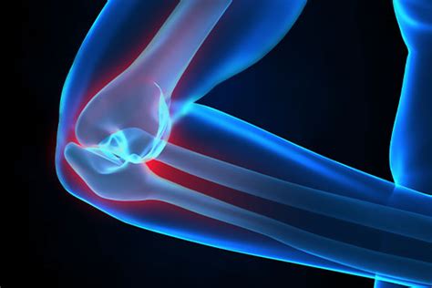 Physical Therapy For Elbow Pain Elbow Pain Treatment And Relief
