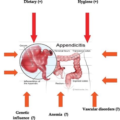 Pdf Demographic And Epidemiologic Features Of Acute Appendicitis