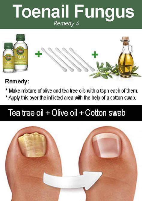 10 Amazing Ways To Use Tea Tree Oil For Toenail Fungus Toenail Fungus