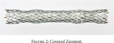 Figure From Newly Developed Fully Covered Metal Stent For