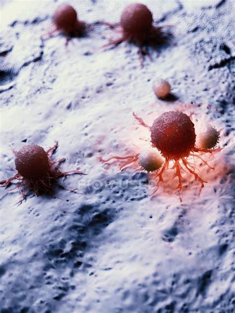 Illustration Of Cancer Cell Being Attacked By White Blood Cells
