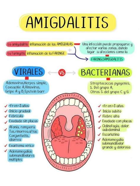 Lista 96 Foto Diferencias Entre Amigdalitis Viral Y B