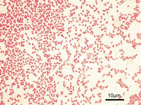 Figure Microscopic Image Of Gram Negative Pseudomonas Aeruginosa