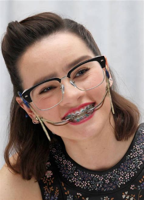 Image By Larry Greenstein On Girls With Dental Braces And Headgear