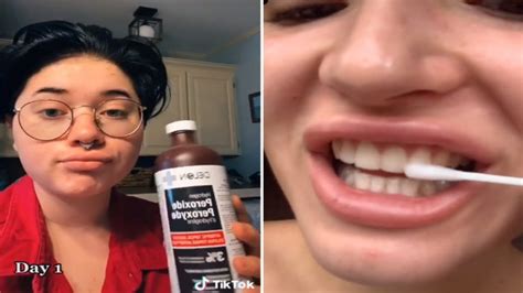How To Use Hydrogen Peroxide As Teeth Whitener Cosmetic Surgery Tips