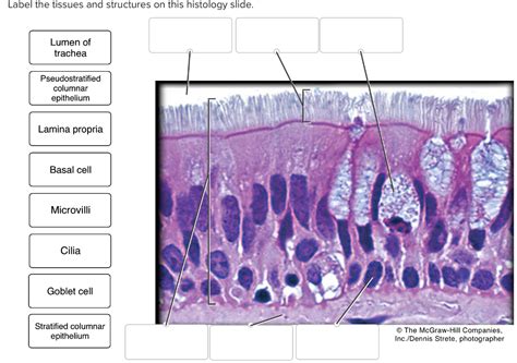 Trachea Histology Slides Labeled