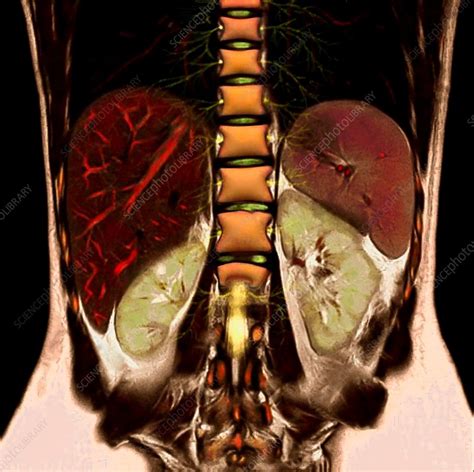 Abdominal Organs And Spine Mri Scan Stock Image C0313219