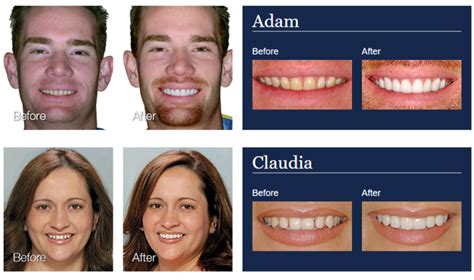 cosmetic dentistry lulu pearl smile dentistry