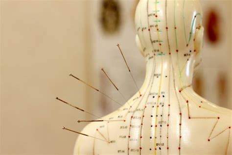 Acupuncture For Heart Disease Acupuncture Blog Best Acupuncture Near Me
