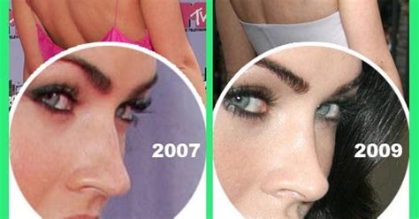 Bonilla Plastic Surgery Megan Fox Before And After