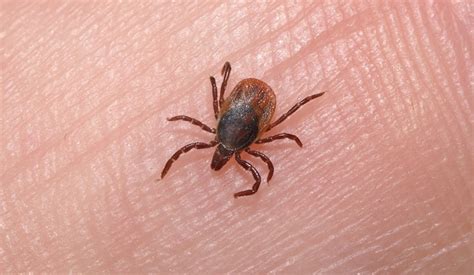 Dreams About Lice - Interpretation and Meaning