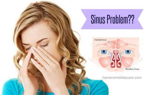 14 Home Remedies To Get Rid Of Sinus Sinusitis Infection Fast