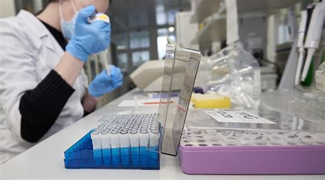 Benefits Of A Lims Managing Your Laboratory Workflows
