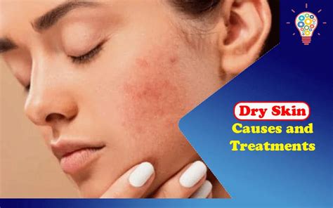 Dry Skin Causes And Treatments Updated Ideas