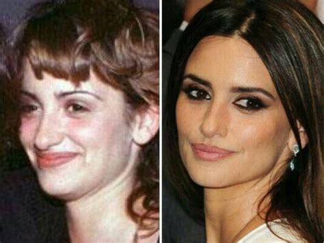 Untitled Nose Job Celebrity Plastic Surgery Celebs Without Makeup