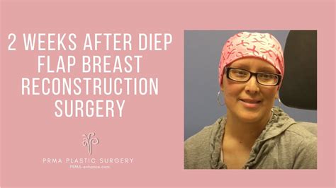 2 Weeks After Diep Flap Breast Reconstruction Surgery Youtube