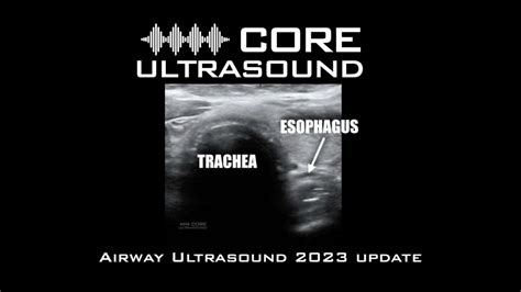 Airway Ultrasound 2023 Update Core Ultrasound