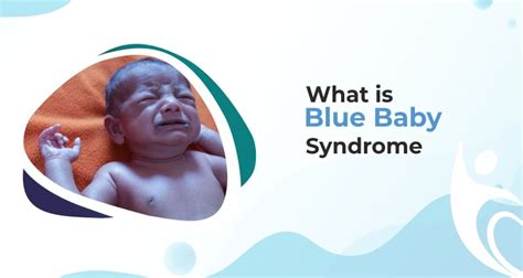 Blue Baby Syndrome Best Pediatrics Cardiologist In Bhagalpur
