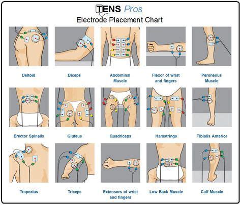 Can you use tens unit while sleeping? TENS unit electrode placement chart for different sports ...