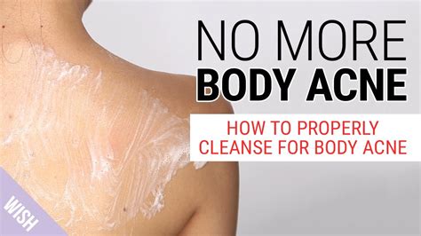 How Do We Get Rid Of Body Acne The Best Body Wash For Body Acne