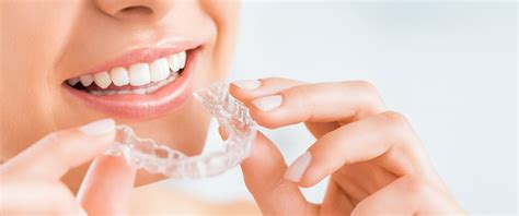 We'll let you know more about these devices that can improve your oral health and keep you retainers are used to hold your teeth in place after braces have shifted them into alignment. Invisalign® - Inspire Dental Group