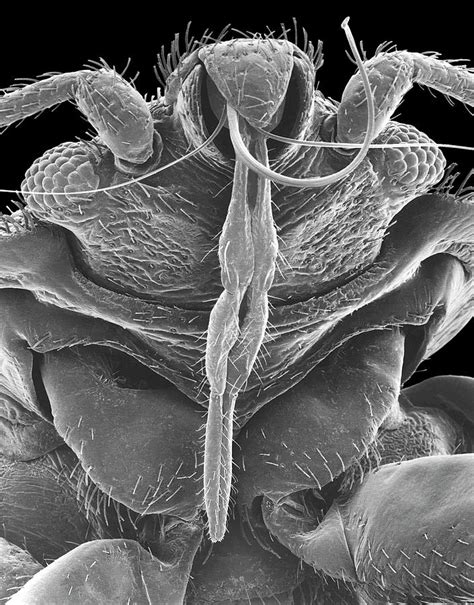 Bed Bug Photograph By Dennis Kunkel Microscopyscience Photo Library