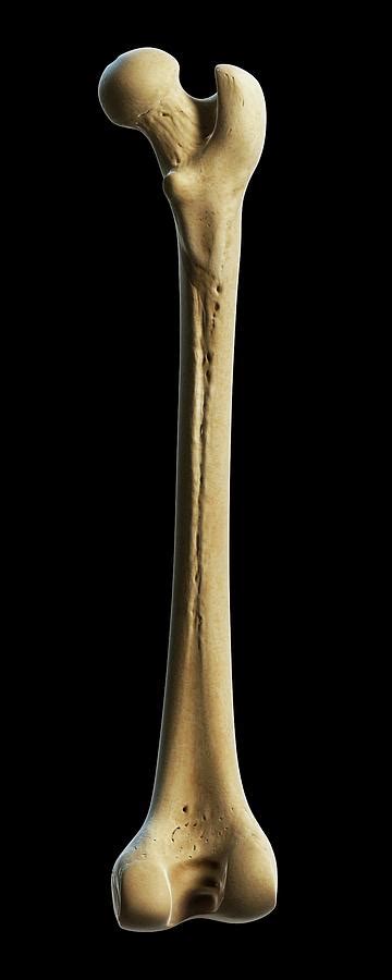 Thigh Bone Photograph By Scieproscience Photo Library Pixels