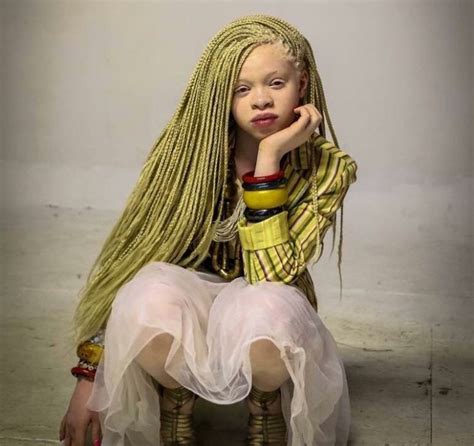 121 Best Albino Images On Pinterest Albino Beautiful