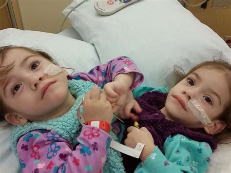 What Life Is Like Now For Formerly Conjoined Twin Sisters After