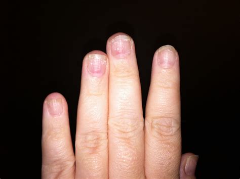 Maybe you would like to learn more about one of these? Tiny plastic fingernails: After glue on full cover nail ...