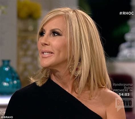 real housewives of orange county s vicki gunvalson boasts about her latest plastic surgery