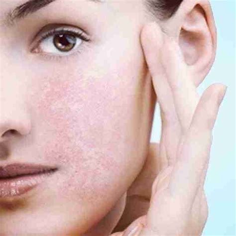 How To Care For Sensitive Skin Organic Apoteke