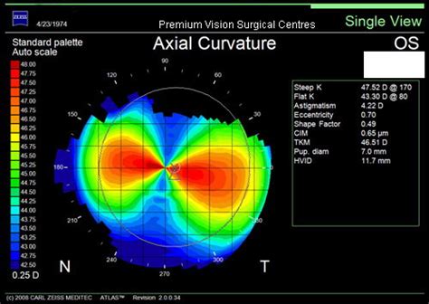 Image OpticianWorks Online Optician Training