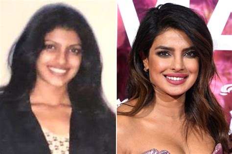 Priyanka Chopras Before And After Evolution Through The Years