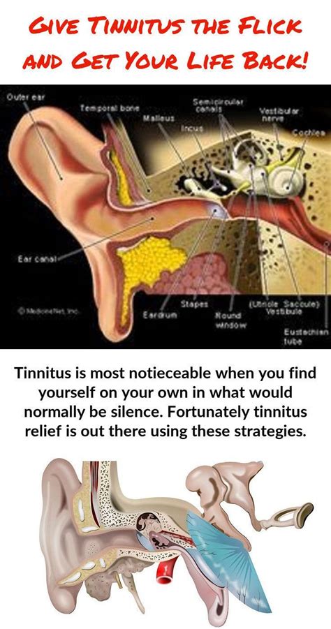 Tinnitus Is Most Notieceable When Youre Alone In What Should Be