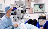 Cataract Surgery Doctor Reviews Images