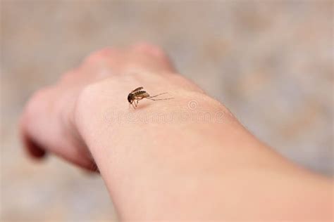 Big Mosquito Bites The Girl In The Arm Stock Image Image Of Animal