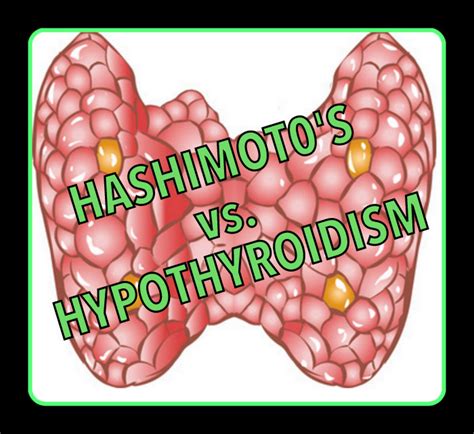 Hypothyroidism Vs Hashimotos Whats Different And Whats Similar