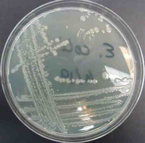 How To Isolate Pure Bacterial Cultures From Clinical Samples