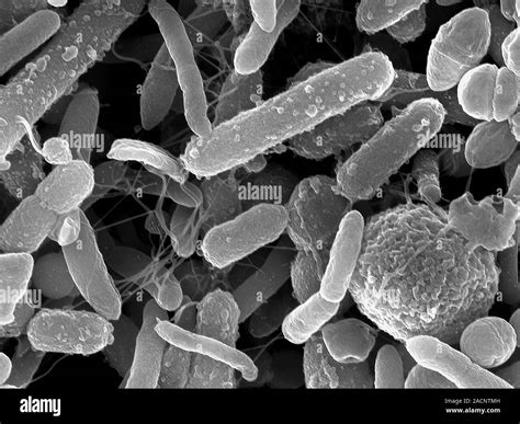 E Coli Bacteria Scanning Electron Micrograph Sem Of Escherichia