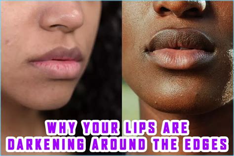 Why Your Lips Are Darkening Around The Edges And What To Do About It